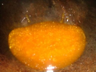 拔丝芋头,炒好的糖浆呈浅黄色(琥珀色)这时侯下原料的效果最好。