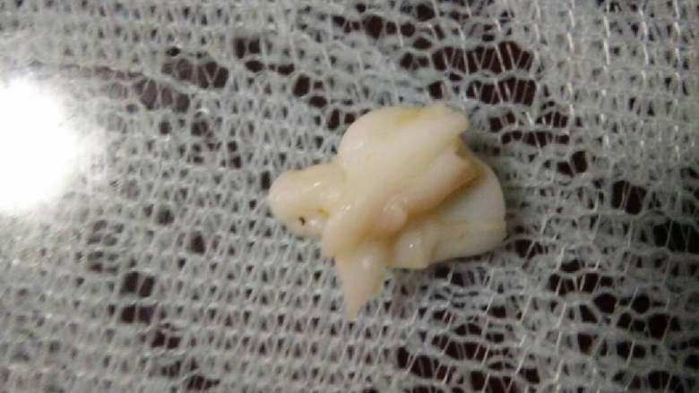 火烧龙虾,我是神