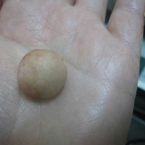 鱼皮花生,收口,搓圆