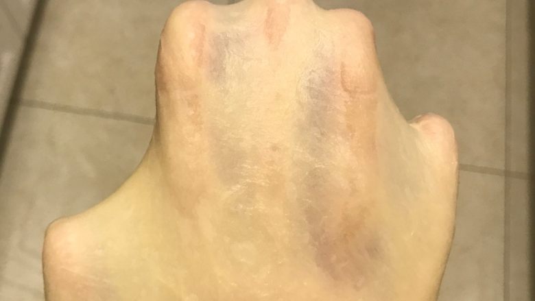 秘制芝心卷边披萨,取出后看看出膜情况,正常出薄膜就可以的,要求完美的亲可配合手揉揉出手套膜。