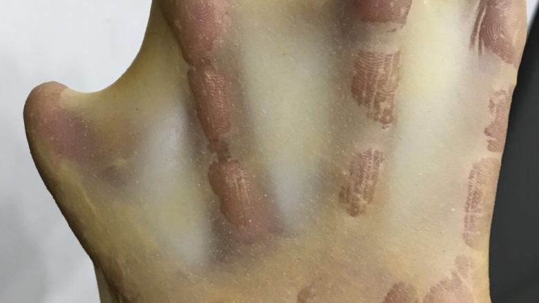 南瓜黄豆粉小餐包,5厨师机二档把黄油揉进面团，转六档揉至接近完全扩展阶段，我一不小心揉到了完全扩展阶段了。