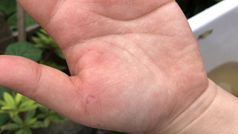 向往的小龙虾🦐,小龙虾的威力不能小觑……真心疼