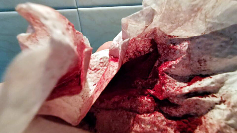 糖醋莲藕,自己磨的红曲粉