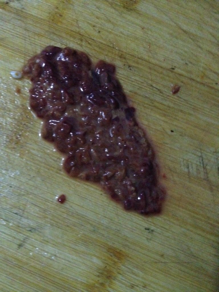 鸡肝粥,如图<a style='color:red;display:inline-block;' href='/shicai/ 95'>鸡肝</a>剁碎